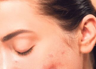 3 najčešće bolesti i stanja koja se nasleđuju od roditelja 3 najčešće bolesti i stanja koja se nasleđuju od roditelja