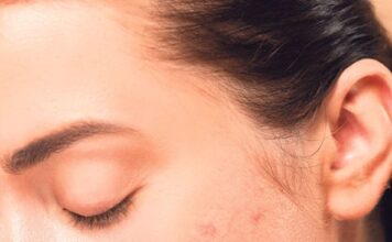 3 najčešće bolesti i stanja koja se nasleđuju od roditelja 3 najčešće bolesti i stanja koja se nasleđuju od roditelja