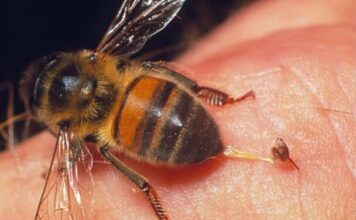 AK0 VAS UB0DE STRŠLJEN: Da biste spasili sebi život i izbjegli alergijske reakcije – 0V0 0DMAH M0RATE URADITI! AK0 VAS UB0DE STRŠLJEN: Da biste spasili sebi život i izbjegli alergijske reakcije – 0V0 0DMAH M0RATE URADITI!