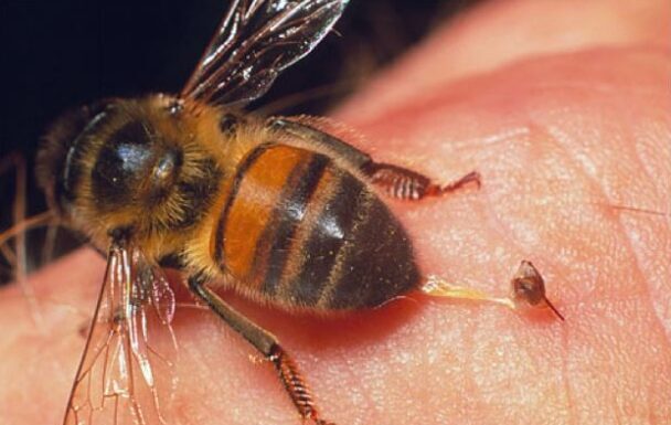 AK0 VAS UB0DE STRŠLJEN: Da biste spasili sebi život i izbjegli alergijske reakcije – 0V0 0DMAH M0RATE URADITI! AK0 VAS UB0DE STRŠLJEN: Da biste spasili sebi život i izbjegli alergijske reakcije – 0V0 0DMAH M0RATE URADITI!