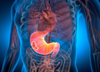 “Ako svako jutro uradite ove 3 stvari – Vaša žučna kesa će raditi kao sat”: Tvrde stručnjaci "Ako svako jutro uradite ove 3 stvari - Vaša žučna kesa će raditi kao sat": Tvrde stručnjaci