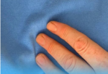 Doktorica upozorava: 90 posto srčanih udara povezano je s jednom jutarnjom navikom Doktorica upozorava: 90 posto srčanih udara povezano je s jednom jutarnjom navikom