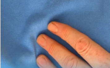 Doktorica upozorava: 90 posto srčanih udara povezano je s jednom jutarnjom navikom Doktorica upozorava: 90 posto srčanih udara povezano je s jednom jutarnjom navikom