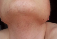 EVO ZAŠTO ŽENE IMAJU DLAKAVU BRADU! Ovo vam organizam govori! EVO ZAŠTO ŽENE IMAJU DLAKAVU BRADU! Ovo vam organizam govori!