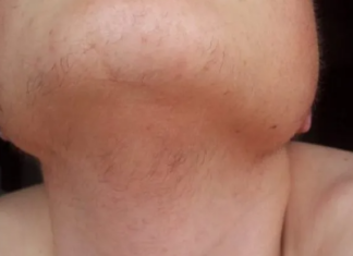 EVO ZAŠTO ŽENE IMAJU DLAKAVU BRADU! Ovo vam organizam govori! EVO ZAŠTO ŽENE IMAJU DLAKAVU BRADU! Ovo vam organizam govori!