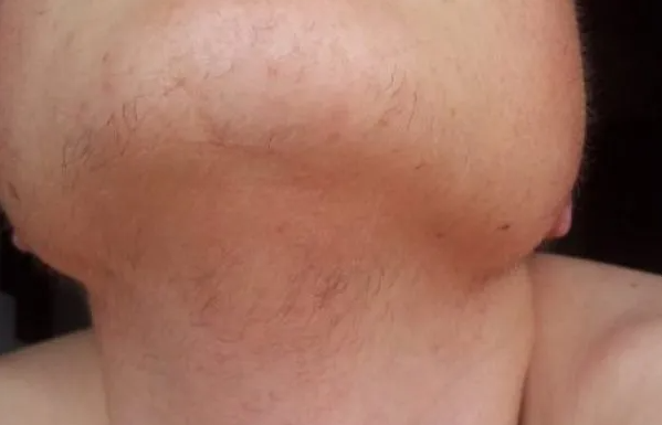 EVO ZAŠTO ŽENE IMAJU DLAKAVU BRADU! Ovo vam organizam govori! EVO ZAŠTO ŽENE IMAJU DLAKAVU BRADU! Ovo vam organizam govori!