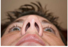 IMATE KONSTANTNO ZAČEPLJEN NOS? Evo šta vam tijelo pokušava reći, DOKTORI UPOZORAVAJU! IMATE KONSTANTNO ZAČEPLJEN NOS? Evo šta vam tijelo pokušava reći, DOKTORI UPOZORAVAJU!