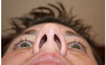 IMATE KONSTANTNO ZAČEPLJEN NOS? Evo šta vam tijelo pokušava reći, DOKTORI UPOZORAVAJU! IMATE KONSTANTNO ZAČEPLJEN NOS? Evo šta vam tijelo pokušava reći, DOKTORI UPOZORAVAJU!