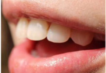 Krvarenje desni može biti znak da vam nedostaje jedna važna stvar Krvarenje desni može biti znak da vam nedostaje jedna važna stvar