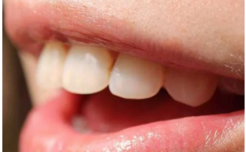 Krvarenje desni može biti znak da vam nedostaje jedna važna stvar Krvarenje desni može biti znak da vam nedostaje jedna važna stvar