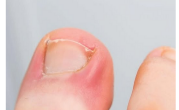 PAZITE SE! Ako nokti pokažu ovaj znak, idite odmah kod ljekara: Upozorenje na PROBLEM koji može biti OZBILJAN PAZITE SE! Ako nokti pokažu ovaj znak, idite odmah kod ljekara: Upozorenje na PROBLEM koji može biti OZBILJAN