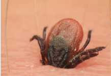 Počela je sezona krpelja, evo kako se zaštiti i kako ga odstraniti iz kože Počela je sezona krpelja, evo kako se zaštiti i kako ga odstraniti iz kože