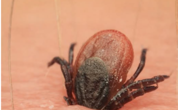 Počela je sezona krpelja, evo kako se zaštiti i kako ga odstraniti iz kože Počela je sezona krpelja, evo kako se zaštiti i kako ga odstraniti iz kože