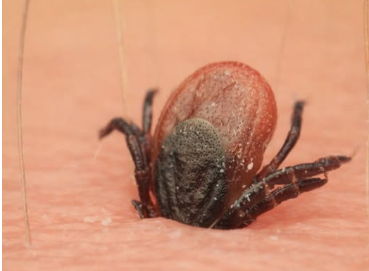 Počela je sezona krpelja, evo kako se zaštiti i kako ga odstraniti iz kože Počela je sezona krpelja, evo kako se zaštiti i kako ga odstraniti iz kože