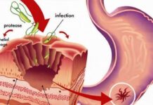 TAKO JE JEDNOSTAVNO, A NISMO ZNALI: Prirodan način uklanjanja BAKTERIJA u ŽELUCU i to za 2 DANA! TAKO JE JEDNOSTAVNO, A NISMO ZNALI: Prirodan način uklanjanja BAKTERIJA u ŽELUCU i to za 2 DANA!