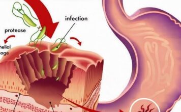 TAKO JE JEDNOSTAVNO, A NISMO ZNALI: Prirodan način uklanjanja BAKTERIJA u ŽELUCU i to za 2 DANA! TAKO JE JEDNOSTAVNO, A NISMO ZNALI: Prirodan način uklanjanja BAKTERIJA u ŽELUCU i to za 2 DANA!