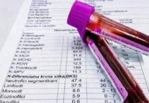 TUMAČENJE KRVNE SLIKE: Šta znače sve one skraćenice i na šta upućuju njihove vrednosti! TUMAČENJE KRVNE SLIKE: Šta znače sve one skraćenice i na šta upućuju njihove vrednosti!