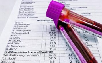 TUMAČENJE KRVNE SLIKE: Šta znače sve one skraćenice i na šta upućuju njihove vrednosti! TUMAČENJE KRVNE SLIKE: Šta znače sve one skraćenice i na šta upućuju njihove vrednosti!