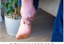 3 ZNAKA VISOKOG HOLESTEROLA: Odmah pogledajte vaše ruke i noge 3 ZNAKA VISOKOG HOLESTEROLA: Odmah pogledajte vaše ruke i noge