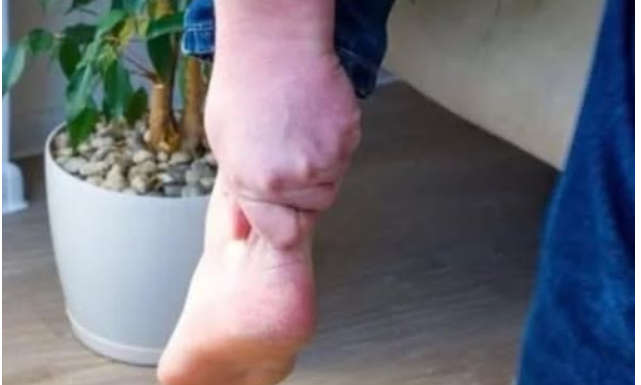 3 ZNAKA VISOKOG HOLESTEROLA: Odmah pogledajte vaše ruke i noge 3 ZNAKA VISOKOG HOLESTEROLA: Odmah pogledajte vaše ruke i noge