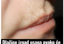 Dlačice iznad usana ovako će zauvijek nestati: Trik u koji se kunu milioni žena Dlačice iznad usana ovako će zauvijek nestati: Trik u koji se kunu milioni žena