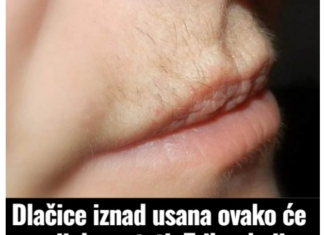 Dlačice iznad usana ovako će zauvijek nestati: Trik u koji se kunu milioni žena Dlačice iznad usana ovako će zauvijek nestati: Trik u koji se kunu milioni žena