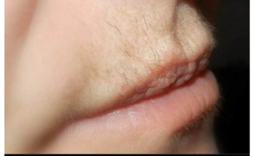 Dlačice iznad usana ovako će zauvijek nestati: Trik u koji se kunu milioni žena Dlačice iznad usana ovako će zauvijek nestati: Trik u koji se kunu milioni žena