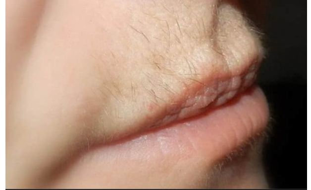 Dlačice iznad usana ovako će zauvijek nestati: Trik u koji se kunu milioni žena Dlačice iznad usana ovako će zauvijek nestati: Trik u koji se kunu milioni žena