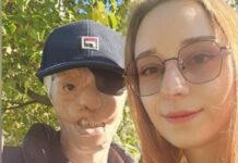 Igor je imao 7 godina kad ga je majka ostavila sa stafordom koji ga je napao i odgrizao pola lica: 25 godina kasnije, život mu je tuga Igor je imao 7 godina kad ga je majka ostavila sa stafordom koji ga je napao i odgrizao pola lica: 25 godina kasnije, život mu je tuga