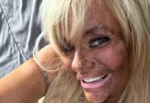 Nakon opsesije za preplanulim tenom bacila se na botoks: Ćerku od 5 godina vodila u solarijum da dobije boju Nakon opsesije za preplanulim tenom bacila se na botoks: Ćerku od 5 godina vodila u solarijum da dobije boju