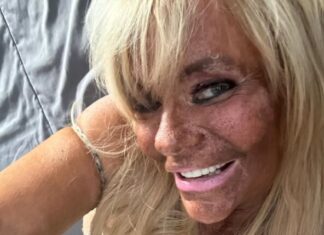 Nakon opsesije za preplanulim tenom bacila se na botoks: Ćerku od 5 godina vodila u solarijum da dobije boju Nakon opsesije za preplanulim tenom bacila se na botoks: Ćerku od 5 godina vodila u solarijum da dobije boju