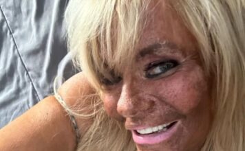 Nakon opsesije za preplanulim tenom bacila se na botoks: Ćerku od 5 godina vodila u solarijum da dobije boju Nakon opsesije za preplanulim tenom bacila se na botoks: Ćerku od 5 godina vodila u solarijum da dobije boju