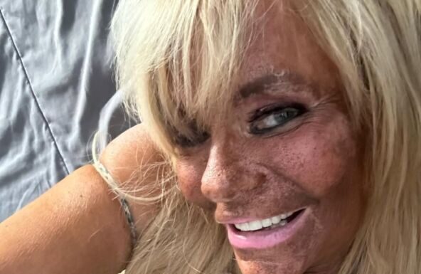 Nakon opsesije za preplanulim tenom bacila se na botoks: Ćerku od 5 godina vodila u solarijum da dobije boju Nakon opsesije za preplanulim tenom bacila se na botoks: Ćerku od 5 godina vodila u solarijum da dobije boju