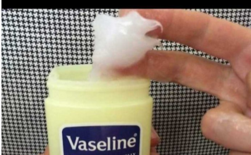 NAMAZALA JE UHO VAZELINOM I SAČEKALA PAR MINUTA Kad vidite rezultat, iste minute ćete uraditi isto NAMAZALA JE UHO VAZELINOM I SAČEKALA PAR MINUTA Kad vidite rezultat, iste minute ćete uraditi isto