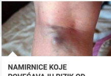 NAMIRNICE KOJE POVEĆAVAJU RIZIK OD TROMBOZE, JEDNA POSEBNO: Jedemo ih svakoga dana, a štete arterijama NAMIRNICE KOJE POVEĆAVAJU RIZIK OD TROMBOZE, JEDNA POSEBNO: Jedemo ih svakoga dana, a štete arterijama