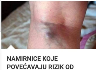 NAMIRNICE KOJE POVEĆAVAJU RIZIK OD TROMBOZE, JEDNA POSEBNO: Jedemo ih svakoga dana, a štete arterijama NAMIRNICE KOJE POVEĆAVAJU RIZIK OD TROMBOZE, JEDNA POSEBNO: Jedemo ih svakoga dana, a štete arterijama