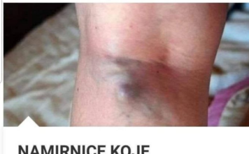 NAMIRNICE KOJE POVEĆAVAJU RIZIK OD TROMBOZE, JEDNA POSEBNO: Jedemo ih svakoga dana, a štete arterijama NAMIRNICE KOJE POVEĆAVAJU RIZIK OD TROMBOZE, JEDNA POSEBNO: Jedemo ih svakoga dana, a štete arterijama