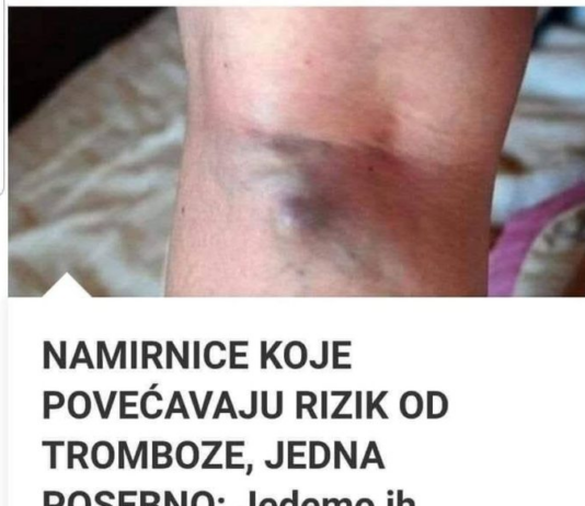 NAMIRNICE KOJE POVEĆAVAJU RIZIK OD TROMBOZE, JEDNA POSEBNO: Jedemo ih svakoga dana, a štete arterijama NAMIRNICE KOJE POVEĆAVAJU RIZIK OD TROMBOZE, JEDNA POSEBNO: Jedemo ih svakoga dana, a štete arterijama