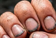 Prsti sa prljavim noktima: znak zapuštenosti ili dokaz napornog rada Prsti sa prljavim noktima: znak zapuštenosti ili dokaz napornog rada