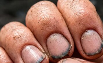 Prsti sa prljavim noktima: znak zapuštenosti ili dokaz napornog rada Prsti sa prljavim noktima: znak zapuštenosti ili dokaz napornog rada