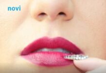 Prvi znak starenja primijeti se oko usana Prvi znak starenja primijeti se oko usana