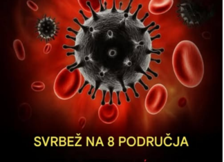 „Šta uzrokuje svrab na različitim dijelovima tijela: kada je bezopasan, a kada potražiti savjet ljekara“ „Šta uzrokuje svrab na različitim dijelovima tijela: kada je bezopasan, a kada potražiti savjet ljekara“