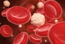 Uspela sam da spustim šećer sa 16 na 5,6 – zastalno: Evo šta sam radila kako bih to postigla Uspela sam da spustim šećer sa 16 na 5,6 - zastalno: Evo šta sam radila kako bih to postigla