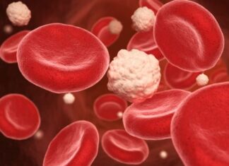 Uspela sam da spustim šećer sa 16 na 5,6 – zastalno: Evo šta sam radila kako bih to postigla Uspela sam da spustim šećer sa 16 na 5,6 - zastalno: Evo šta sam radila kako bih to postigla