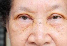 VOĆKA BROJ 1 PROTIV HOLESTEROLA, PRITISKA I MOŽDANOG UDARA: Ko je jede, bit će zdrav kao drijen VOĆKA BROJ 1 PROTIV HOLESTEROLA, PRITISKA I MOŽDANOG UDARA: Ko je jede, bit će zdrav kao drijen