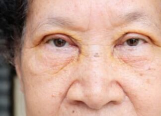 VOĆKA BROJ 1 PROTIV HOLESTEROLA, PRITISKA I MOŽDANOG UDARA: Ko je jede, bit će zdrav kao drijen VOĆKA BROJ 1 PROTIV HOLESTEROLA, PRITISKA I MOŽDANOG UDARA: Ko je jede, bit će zdrav kao drijen