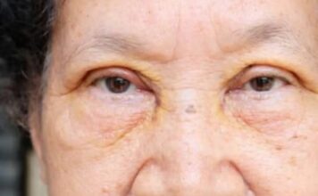 VOĆKA BROJ 1 PROTIV HOLESTEROLA, PRITISKA I MOŽDANOG UDARA: Ko je jede, bit će zdrav kao drijen VOĆKA BROJ 1 PROTIV HOLESTEROLA, PRITISKA I MOŽDANOG UDARA: Ko je jede, bit će zdrav kao drijen