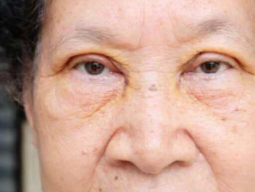 VOĆKA BROJ 1 PROTIV HOLESTEROLA, PRITISKA I MOŽDANOG UDARA: Ko je jede, bit će zdrav kao drijen VOĆKA BROJ 1 PROTIV HOLESTEROLA, PRITISKA I MOŽDANOG UDARA: Ko je jede, bit će zdrav kao drijen