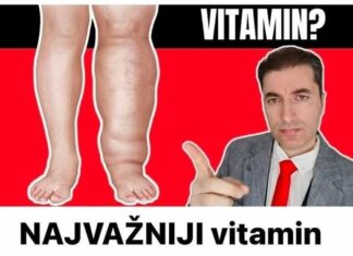 NAJVAŽNIJI vitamin za otklanjanje otoka ruku, nogu i stopala! NAJVAŽNIJI vitamin za otklanjanje otoka ruku, nogu i stopala!