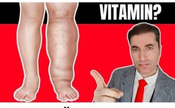 NAJVAŽNIJI vitamin za otklanjanje otoka ruku, nogu i stopala! NAJVAŽNIJI vitamin za otklanjanje otoka ruku, nogu i stopala!